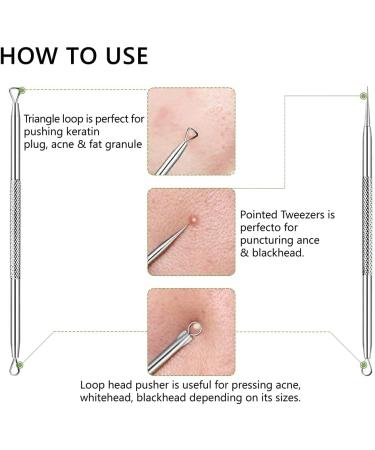 Japard Professional 5 Pcs Blackhead Remover Kit - Stainless Steel Tools for Acne, Pimple, Blemish, and Whitehead Removal on Nose and Face - Buy Online on GoSupps.com
