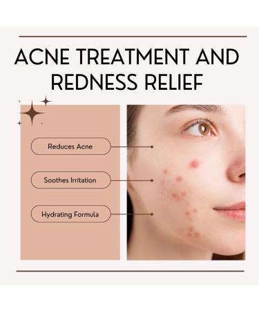 10% Azelaic Acid Cream - Acne Treatment Redness Relief & Skin Soothing | 1.7 fl oz (50ml - Buy Online on GoSupps.com