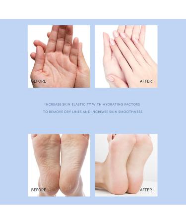 Cr me Hydratante Et Anti-Ger ures for Les Pieds Cr me R paratrice for Les Mains Et Les Pieds Masques Hydratants Et Anti-Ger ures for Les Pieds Les Genoux Les Coudes Et Les Callosit s Des Mains(Uns Unscented - Buy Online on GoSupps.com