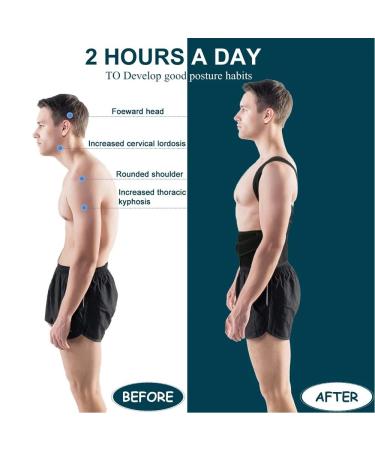 Breathable Back Brace Posture Corrector for Women & Men | Adjustable Scoliosis & Hunchback Trainer | Small Black - Buy Online on GoSupps.com