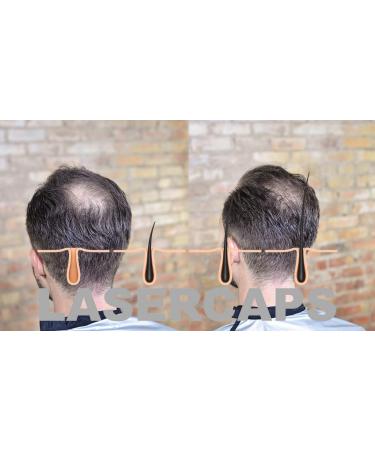 Buy Laser Caps for Hair Growth | International Shipping Available - Buy Online on GoSupps.com