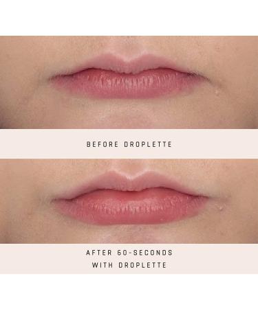 Droplette 17-Volt Lip Plumper Refill | 14 Count - Buy Online on GoSupps.com