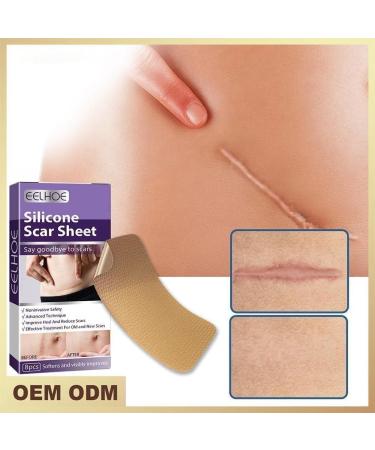 WAITLOVER Skin Color Reusable Silicone Scar Removal Patch - Surgical Self-Adhesive Soft Gel Strip for Burn Repair - Buy Online on GoSupps.com