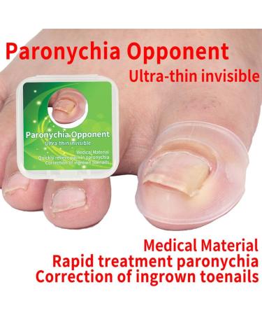 Ingrown Toenail Corrector Pain Relief Treatment Tool Made of Silicone Transparent Simple and Effective - Buy Online on GoSupps.com