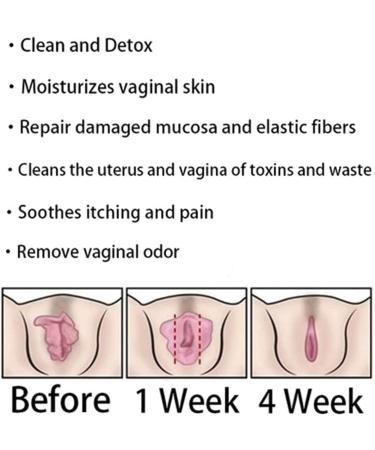 Dengwang Anniecare Natural Vaginal Repair Capsules and Detox Gel (Pack of 3 Boxes) - Buy Online on GoSupps.com