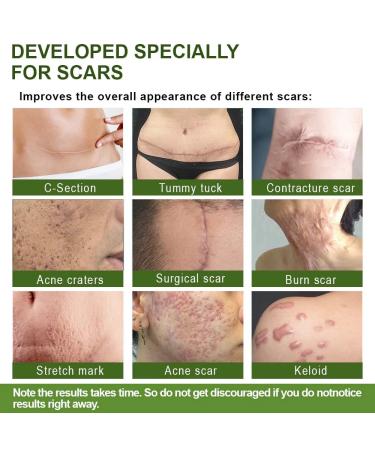 Goopgen Advanced Scar Repair Serum - Medical Grade Treatment for All Types of Scars (4PCS) - Buy Online on GoSupps.com