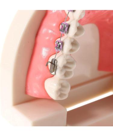 Dytah Orthodontic Demonstration Model - Teeth Study Model with Metal Arch Wire & Brackets for Effective Teaching - Buy Online on GoSupps.com