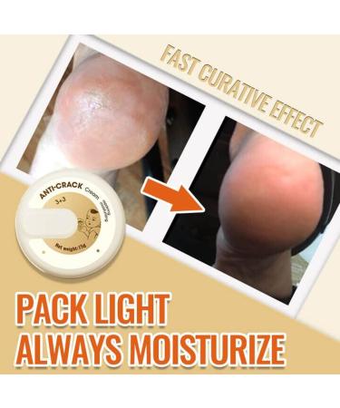 Yutingchby Natural Winter Foot Cream - 100% Moisturizing Anti-Cracking Solution for Rough Dry and Cracked Hands - Buy Online on GoSupps.com