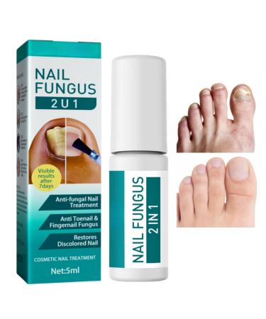 2 IN 1 Fungal Nail Treatment Nail Repair Essence For Toenails Anti Fungal Nail Treatment Toenail Fungus Treatment Nail Fungus Serum For Toenail Nail Fungal Treatment Extra Strength Fast Nail Repair