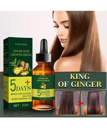 Dermaroller Set Microneedling with Hair Growth Serum Anti Hair Loss Hair Growth Agent Professional Titanium Needles Skin Roller for Stimulating New Hair Growth (0.25mm kit) - Buy Online on GoSupps.com