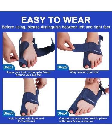 2022 Updated Toe Separator Bunion Corrector Set - Bunion Splint & Hallux Valgus Brace Kit for Bunion Pain Relief - Orthopedic Toe Alignment Tool with Free Blue Exercise Strap - Buy Online on GoSupps.com