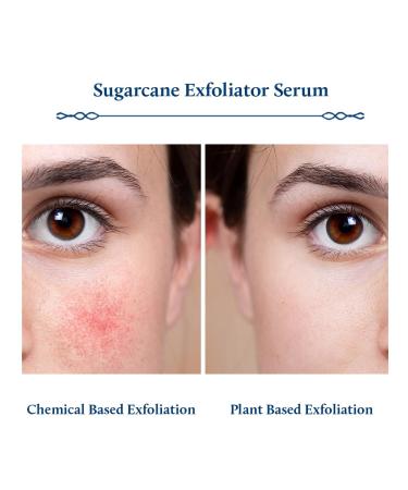 Blue Nectar AHA Exfoliating Face Serum | Plant-Based Glycolic Acid | Deep Exfoliation for Blackheads & Tan Removal | 10 Min Facial Treatment | 14 Herbs (1 Fl Oz - Buy Online on GoSupps.com