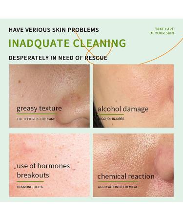 BLMBAY 3 PCS Aloe Vera Gel Smoothing After Sun Deeply Hydrating Nourishing Skin Care for Face Body and Hair - Sunburn Redness and Itchy Skin Relief 1.41 Fl Oz - Buy Online on GoSupps.com