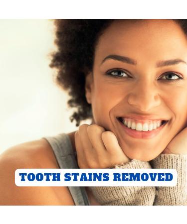 Sensitive Teeth Whitening Strips - Non Peroxide, Gentle Whitener Band Kit - 28 Pcs, 14 Treatments, 2 Week Supply - Buy Online on GoSupps.com