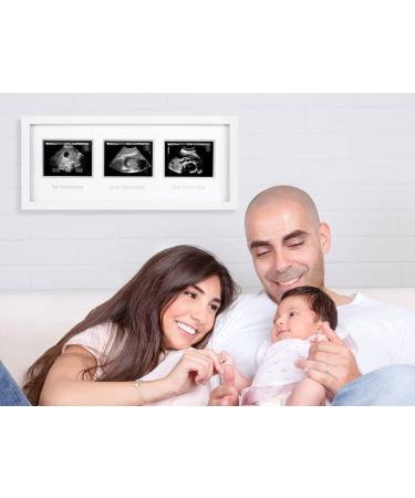 Pearhead Trimester Progression Sonogram Picture Frame - Gender-Neutral Pregnancy Milestone Keepsake for Baby Nursery D cor - Ideal Mother's Day Gift - Buy Online on GoSupps.com