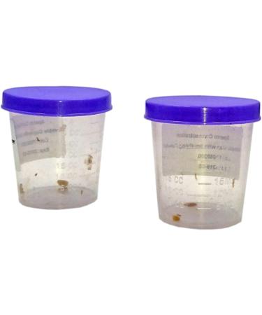 Male and Female Fertility Test Kit Bundle - Active Sperm Test + FSH Test - Easy One Step Process - Buy Online on GoSupps.com