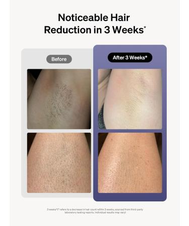 Ulike Laser Hair Removal Device for Women and Men Air 3 IPL Hair Removal with Sapphire Ice-Cooling System for Nearly Painless & Long-Lasting Result Flat-Head Window for Body & Face at-Home Use - Buy Online on GoSupps.com