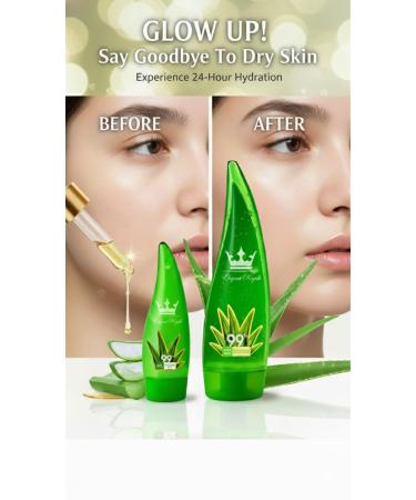 Elegant Royale Aloe Vera Skincare Set 99% Pure Aloe Vera Gel (9 oz) + Gentle Exfoliating Scrub (6 oz) Natural Hydrating & Soothing Face & Body Combo for Dry Sensitive Skin Sunburn & Glow - Buy Online on GoSupps.com