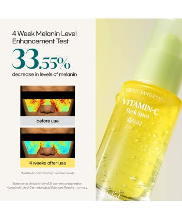 GOODAL Green Tangerine Vitamin C Dark Spot Serum - Brighten & Reduce Dark Spots - 1.01 Fl.Oz. - Buy Online on GoSupps.com