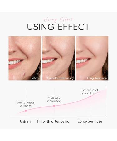 Skincare Set - Sakura 9PCS Kit with Cleanser Toner Serum Cream & Masks for Teenage Girls & Women - Buy Online on GoSupps.com