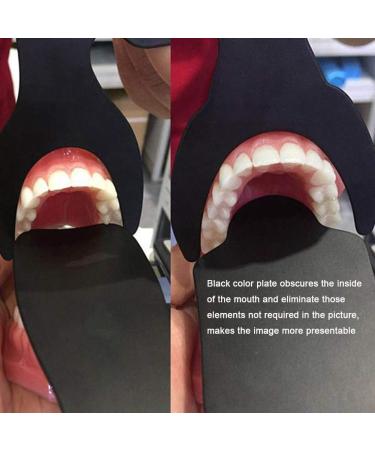 Dental Photography Contrast Board Set 6 Pieces Black Background Palatal Contraster with Scale - Buy Online on GoSupps.com