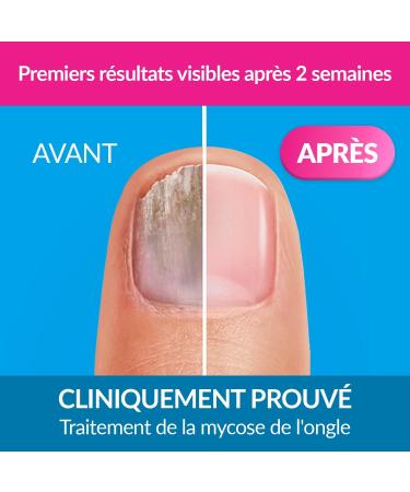 Excilor Treatment for Nail Mycosis Solution 3.3ml - Buy Online on GoSupps.com