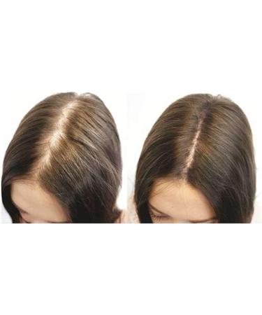 100% Natural Keratin Hair Fibre Refill for Hair Loss - Alopecia & Chemotherapy (25g) Light Brown - Pack of 1 - Buy Online on GoSupps.com