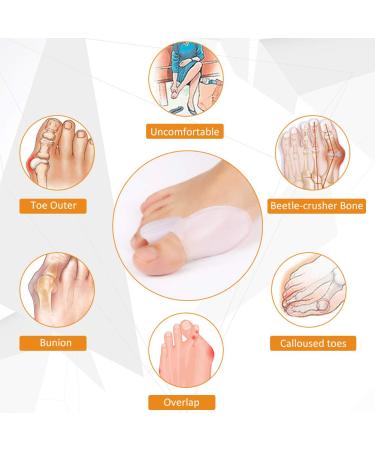 Gel Big Toe Bunion Guard Kit - Men and Women Bunion Corrector & Straightener for Hammer Toe. Ideal for Running & Sleeping - Day/Night Treatment - Buy Online on GoSupps.com