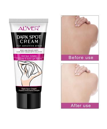 IDUCEN Body Whitening Cream - Skin Brightening Formula for Radiant Skin - Buy Online on GoSupps.com