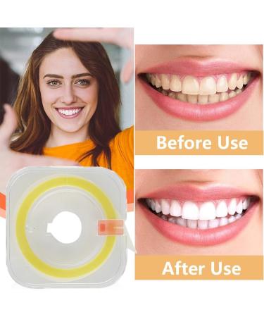 Ultra-Fine Lsojfe Tooth Sandpaper & Dental Polishing Strips - 20 m Interdental Grinding Tool 4mm Width - Buy Online on GoSupps.com