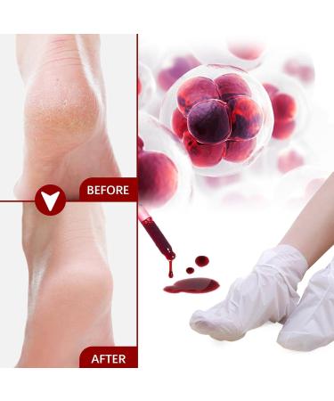 Eteslot Peeling Socks | Foot Care Treatment for Cracked Heels & Dead Skin - International Shipping Available - Buy Online on GoSupps.com