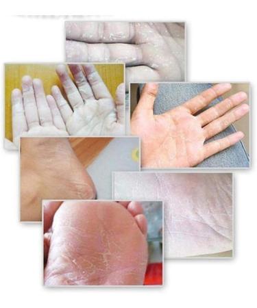 HELLOYOUNG 1 Box 20g Natural Banana Oil Anti-Drying Crack Foot Cream Foot Heel Cracked Repair Cream Ointments Care - Buy Online on GoSupps.com