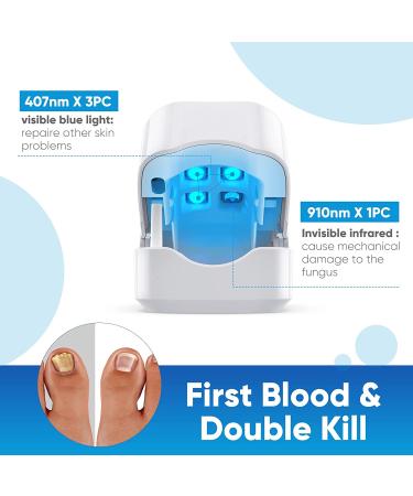 Advanced Nail Fungus Cleaning Laser Treatment Device - Home Use Toenail Therapy - Buy Online on GoSupps.com
