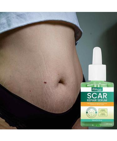 Imtrub Scar Guards Moisturizing Scar Repair Oil for Skin Repair 30 ml Scar Repair Smoothing to Reduce Scar Scars Pregnancy - Buy Online on GoSupps.com