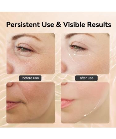 Neck Face Massager - Facial Massager Device with 3 Color Modes & Vibration - Face Sculpting Tool for Double Chin (White) | Shop Internationally - Buy Online on GoSupps.com