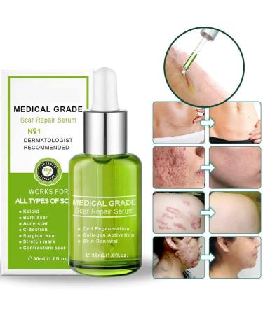 Goopgen Advanced Scar Repair Serum - Medical Grade Scar Removal Treatment for All Types of Scars (2Pcs) - Buy Online on GoSupps.com