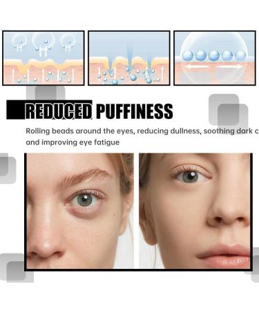 Time Eraser Rollerball with 100% Organic Castor Oil & Frankincense - Anti-Wrinkle Serum for Eyes Reduces Fine Lines (2 PCS) - International Shipping - Buy Online on GoSupps.com
