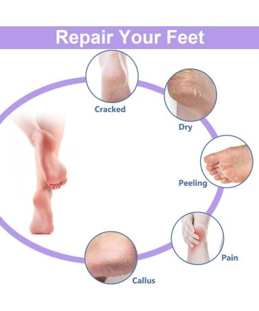 2 Pairs Moisturizing Socks Gel Heel Socks Toe Open Socks Relieve Heel Pain Comfortable Soft Vented Moisturizing Socks Suitable for Male and Female Day Night Care Skin Dry Cracked High Heel Purple_Skin - Buy Online on GoSupps.com