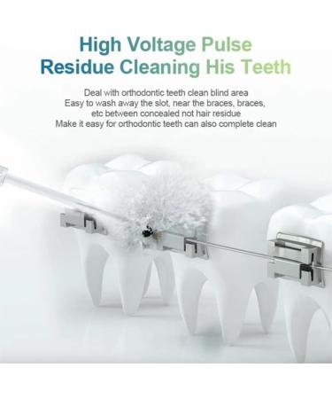 Portable Dental Flosser Water Jet Oral Irrigator for Teeth Dentures & Braces - Rechargeable Multiple Pressure Modes - International Shipping Available - Buy Online on GoSupps.com