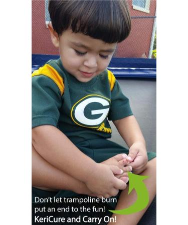 Kids Natural Seal Liquid Bandage Spray 1oz - Sting-Free, Moisturizing, Soothing Protection | Woman-Owned Small Business - Buy Online on GoSupps.com