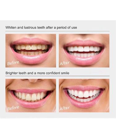 Icoyea Smile Powder Tooth Powder Teeth Whitening Powder Mint Tooth Powder Tooth Stain Remover Dental Care Teeth Whitening Products (1pcs) - Buy Online on GoSupps.com