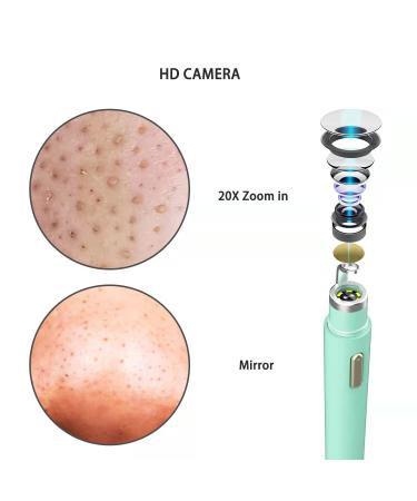 Womfenn Blackhead Remover 2022 - Advanced Pimple Popper with Camera | Acne Comedone Extractor Kit for Skin Care | Pore Clean Tool | 20X Zoom Aquamarine 01 - Buy Online on GoSupps.com