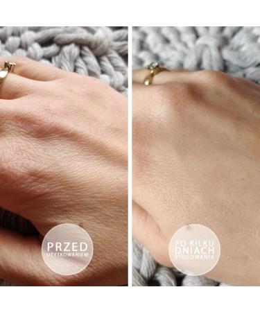 BEAUTICA S.O.S. Intensively oily ointment with vitamin E 100ml - Buy Online on GoSupps.com