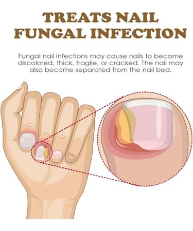NailGrowth DeepHealing Organic Serum NailGrowth Nail Serum Reconstrux Nail Growth Nail Growth and Strengthening Serum Nail Serum for Growth and Repair for Damaged Nails (3pcs) - Buy Online on GoSupps.com