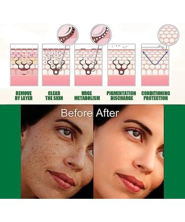 (Must - Have) 2 Jar Dark Spot Correcting Glow Serum Face Skin Serum for Dark Spot Treatment Hydration Moisturizing Lotion Improves Skin Skin - Buy Online on GoSupps.com