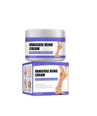 Cream against spider veins for effective treatment of varicose veins Treatment Legs Cream soothes and moisturizes quickly