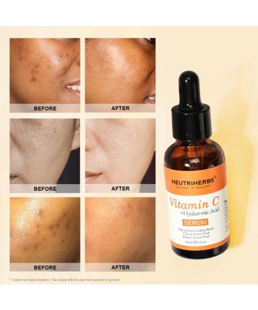 Buy NEUTRIHERBS Vitamin C Serum with Hyaluronic Acid - Anti-Aging Brightening Facial Serum for Daily Skincare - 1 fl oz - Buy Online on GoSupps.com