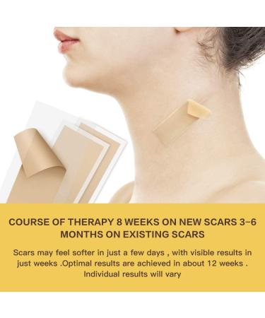 Professional Silicone Scar Removal Sheets - Box of 8, Reusable & Washable - for Scars, Keloids, Burns & Surgery - 5.9x1.6 - Effective Keloid Scar Removal Patch - Buy Online on GoSupps.com