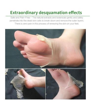 Xuejian Aloe Vera Foot Mask Socks - Exfoliating Peeling Socks for Pedicure & Callus Removal - Buy Online on GoSupps.com