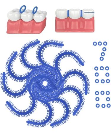 Braces Separator - 700 PCS Teeth Elastic Orthodontic Ligature Ties Rubber Bands for Effective Dental Care - Buy Online on GoSupps.com